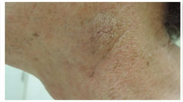 Persistent itchy skin, unrelated to allergies, can signal liver issues