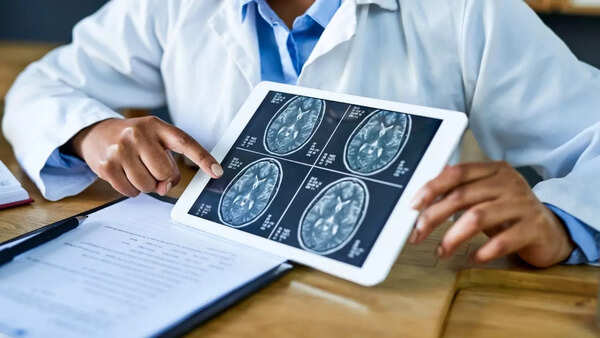 Conceptual image of a damaged brain.