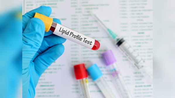 Blood test results showing lipid markers for heart health.
